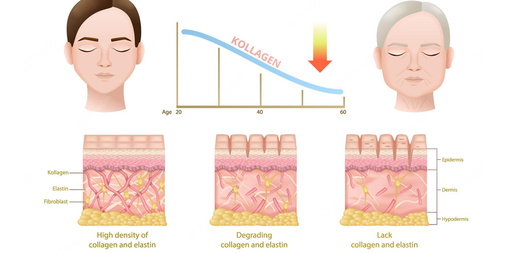 Skin aging